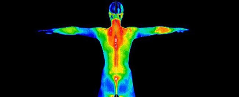 thermography-image
